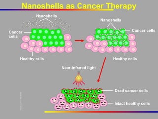 Nanoshells as Cancer Therapy
Nanoshells

Nanoshells
Cancer cells

Cancer
cells

Healthy cells

Healthy cells
Near-infrared light

Dead cancer cells
Intact healthy cells

 