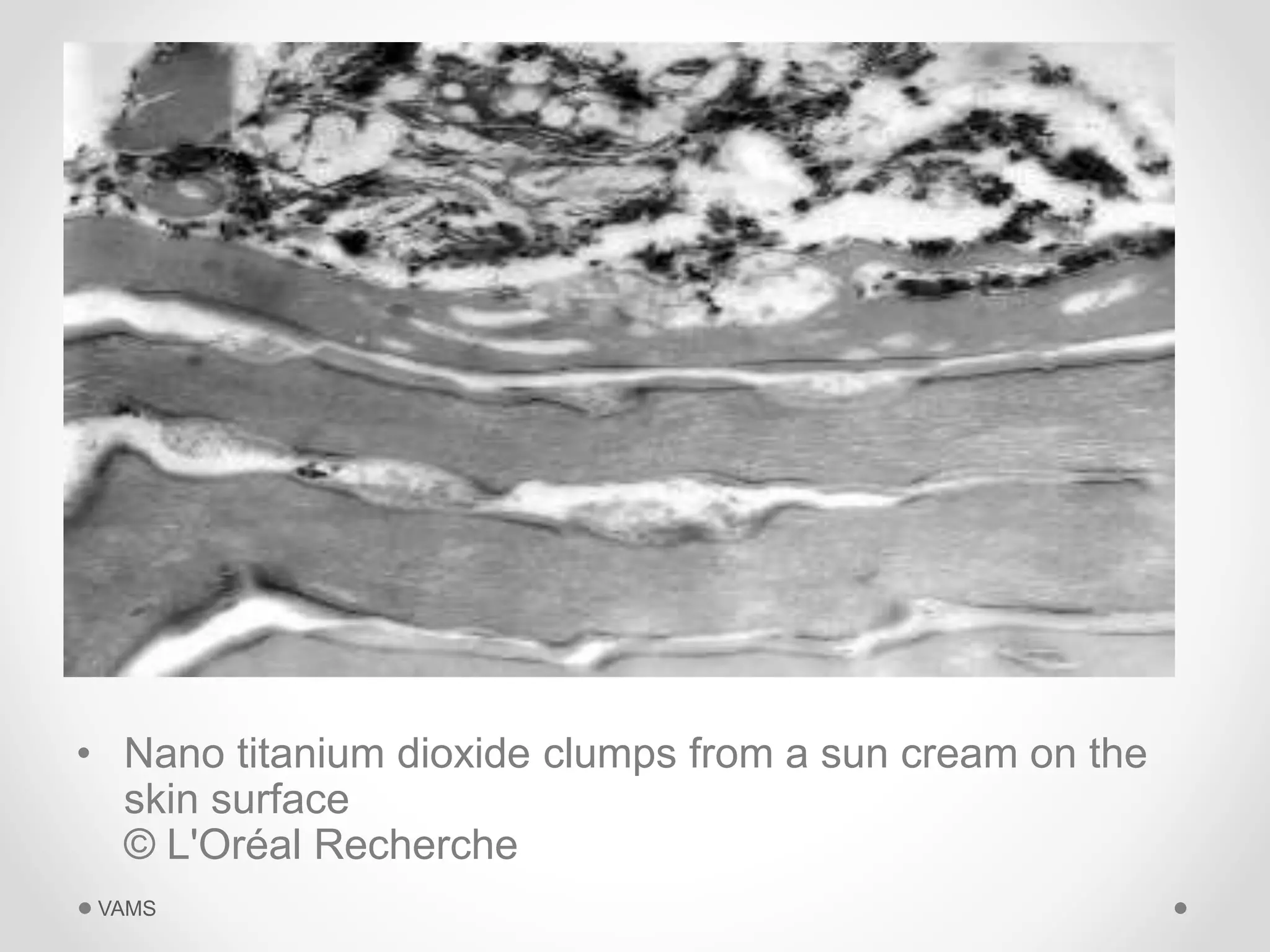 • Nano titanium dioxide clumps from a sun cream on the 
skin surface 
© L'Oréal Recherche 
VAMS 
 