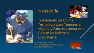 NanoKnife
Tratamiento de Última
Tecnología para Tumores en
Hígado y Páncreas ahora en la
Ciudad de México y
Guadalajara
Dr. Carlos Flórez Zorrilla
www.cirugiadehigado.wordpress.com
carlosflorez@zoho.com
 