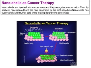 Nano shells as Cancer Therapy
Nano shells are injected into cancer area and they recognize cancer cells. Then by
applying near-infrared light, the heat generated by the light-absorbing Nano shells has
successfully killed tumor cells while leaving neighboring cells intact.
 