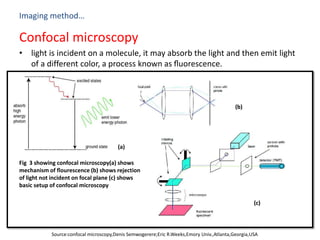 Imaging method…
Confocal microscopy
• light is incident on a molecule, it may absorb the light and then emit light
of a different color, a process known as ﬂuorescence.
Fig 3 showing confocal microscopy(a) shows
mechanism of flourescence (b) shows rejection
of light not incident on focal plane (c) shows
basic setup of confocal microscopy
Source:confocal microscopy,Denis Semwogerere;Eric R.Weeks,Emory Univ.,Atlanta,Georgia,USA
(a)
(b)
(c)
 