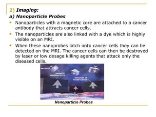2)   Imaging: a) Nanoparticle Probes Nanoparticles with a magnetic core are attached to a cancer antibody that attracts cancer cells.  The nanoparticles are also linked with a dye which is highly visible on an MRI.  When these nanoprobes latch onto cancer cells they can be detected on the MRI. The cancer cells can then be destroyed by laser or low dosage killing agents that attack only the diseased cells.  Nanoparticle Probes 