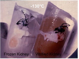 Frozen Kidney Vitrified Kidney -130°C 