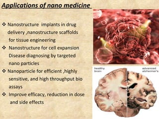 <ul><li>Applications of nano medicine  </li></ul><ul><li>Nanostructure  implants in drug  </li></ul><ul><li>delivery ,nano...
