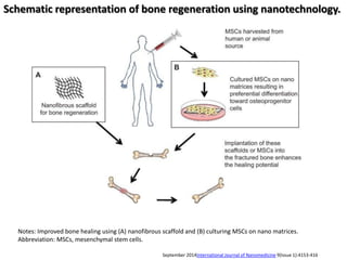 Schematic representation of bone regeneration using nanotechnology.
September 2014International Journal of Nanomedicine 9(Issue 1):4153-416
Notes: Improved bone healing using (A) nanofibrous scaffold and (B) culturing MSCs on nano matrices.
Abbreviation: MSCs, mesenchymal stem cells.
 