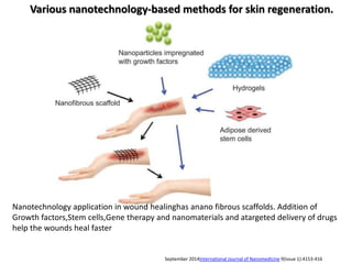 Various nanotechnology-based methods for skin regeneration.
September 2014International Journal of Nanomedicine 9(Issue 1):4153-416
Nanotechnology application in wound healinghas anano fibrous scaffolds. Addition of
Growth factors,Stem cells,Gene therapy and nanomaterials and atargeted delivery of drugs
help the wounds heal faster
 