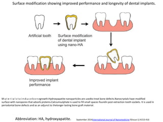 Surface modification showing improved performance and longevity of dental implants.
September 2014International Journal of Nanomedicine 9(Issue 1):4153-416
Abbreviation: HA, hydroxyapatite.
M a t e r i a l s t o i n d u c e b o n egrowth:Hydroxyapatite nanoparticles are usedto treat bone defects.Nanocrystals have modified
surface with nanopores that adsorb proteins.Calciumsulphate is used to fill small spaces foundin post extraction tooth sockets. It is used in
periodontal bone defects and as an adjunct to thelonger lasting bone graft material.
 