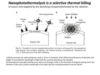 Nanophotothermolysis is a selective thermal killing
of cancer cells targeted by the absorbing nanoparticlesheated by the radiation.
.(1)Gold nanorods are solid cylindersas small as 10 nm in diameter. With differentcombinations of diameter and
length of nanorods,the wavelength of light that the nanorod absorbscan be changed.
(2) Nanospheres have gold coating overa silica core.Changes made in the thickness of thegold coating and in the
diameter of the silica corethe wavelength of the light that the nanosphereabsorb may be altered
 