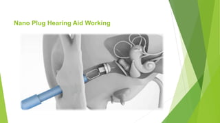 Nano Plug Hearing Aid Working
 