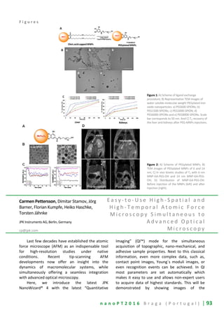 n a n o P T 2 0 1 6 B r a g a ( P o r t u g a l ) | 93
F i g u r e s
Figure 1: A) Scheme of ligand exchange
procedure; B) Representative TEM images of
water soluble molecular weight PEGylated iron
oxide nanoparticles: a) PEG600-SPIONs; b)
PEG1500-SPIONs; c) PEG3000-SPION; d)
PEG6000-SPIONs and e) PEG8000-SPIONs. Scale
bar corresponds to 50 nm. And C) T2 recovery of
the liver and kidneys after PEG-MNPs injections.
Figure 2: A) Scheme of PEGylated MNPs; B)
TEM images of PEGylated MNPs of 6 and 14
nm; C) In vivo kinetic studies of T2 with 6 nm
MNP-GA-PEG-OH and 14 nm MNP-GA-PEG-
OH; D) Distribution of MNP-GA-PEG-OH.
Before injection of the MNPs (left) and after
injection (right).
Carmen Pettersson, Dimitar Stamov, Jörg
Barner, Florian Kumpfe, Heiko Haschke,
Torsten Jähnke
JPK Instruments AG, Berlin, Germany
cp@jpk.com
E a s y - t o - U s e H i g h - S p a t i a l a n d
H i g h - T e m p o r a l A t o m i c F o r c e
M i c r o s c o p y S i m u l t a n e o u s t o
A d v a n c e d O p t i c a l
M i c r o s c o p y
Last few decades have established the atomic
force microscope (AFM) as an indispensable tool
for high-resolution studies under native
conditions. Recent tip-scanning AFM
developments now offer an insight into the
dynamics of macromolecular systems, while
simultaneously offering a seamless integration
with advanced optical microscopy.
Here, we introduce the latest JPK
NanoWizard® 4 with the latest “Quantitative
Imaging” (QI™) mode for the simultaneous
acquisition of topographic, nano-mechanical, and
adhesive sample properties. Next to this classical
information, even more complex data, such as,
contact point images, Young´s moduli images, or
even recognition events can be achieved. In QI
most parameters are set automatically which
makes it easy to use and allows non-expert users
to acquire data of highest standards. This will be
demonstrated by showing images of the
 