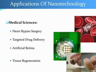Medical Sciences:
 Heart Bypass Surgery
 Targeted Drug Delivery
 Artificial Retina
 Tissue Regeneration
Applications Of Nanotechnology
 