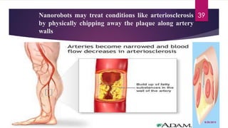 Nanorobots may treat conditions like arteriosclerosis
by physically chipping away the plaque along artery
walls
8/20/2015
39
 
