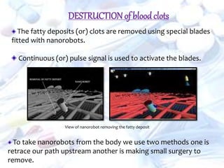 DESTRUCTIONof blood clots
The fatty deposits (or) clots are removed using special blades
fitted with nanorobots.
Continuous (or) pulse signal is used to activate the blades.
View of nanorobot removing the fatty deposit
To take nanorobots from the body we use two methods one is
retrace our path upstream another is making small surgery to
remove.
 