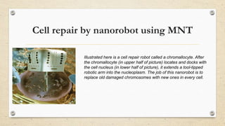 Cell repair by nanorobot using MNT
Illustrated here is a cell repair robot called a chromallocyte. After
the chromallocyte (in upper half of picture) locates and docks with
the cell nucleus (in lower half of picture), it extends a tool-tipped
robotic arm into the nucleoplasm. The job of this nanorobot is to
replace old damaged chromosomes with new ones in every cell.

 