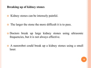 Breaking up of kidney stones
 Kidney stones can be intensely painful.
 The larger the stone the more difficult it is to pass.
 Doctors break up large kidney stones using ultrasonic
frequencies, but it is not always effective.
 A nanorobot could break up a kidney stones using a small
laser.
19
 