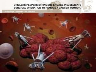 DRILLERS,PEEPERS,STRINGERS ENGAGE IN A DELICATE
SURGICAL OPERATION TO REMOVE A CANCER TUMOUR.
 