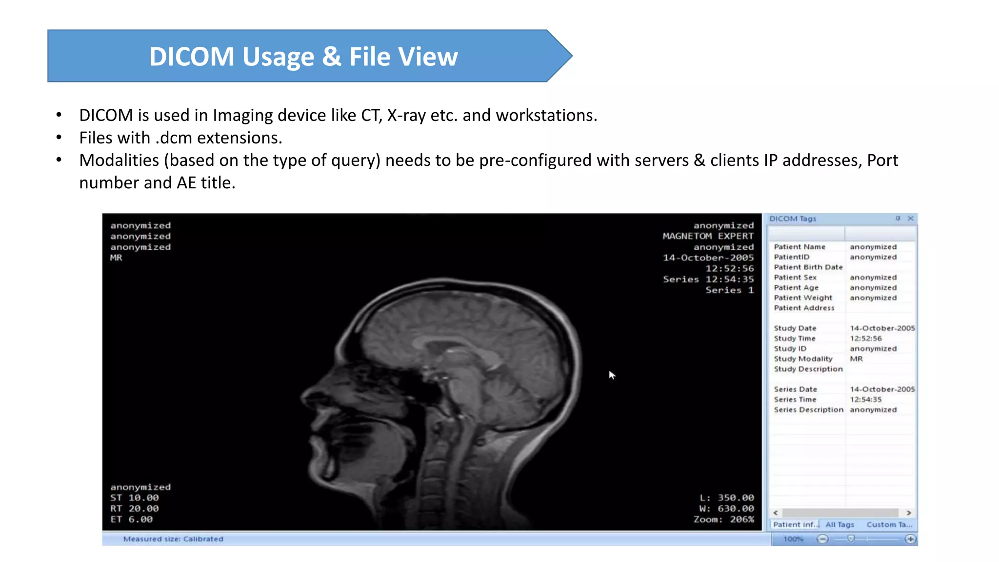 DICOM Usage & File View
• DICOM is used in Imaging device like CT, X-ray etc. and workstations.
• Files with .dcm extensions.
• Modalities (based on the type of query) needs to be pre-configured with servers & clients IP addresses, Port
number and AE title.
 