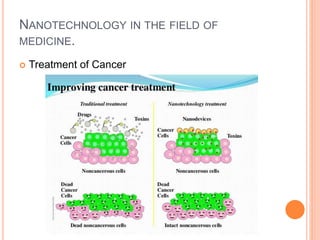NANOTECHNOLOGY IN THE FIELD OF
MEDICINE.
 Treatment of Cancer
 