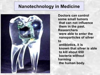 Nanotechnology in Medicine
Doctors can control
some small tumors
that can not influence
them in the past.
Researchers
were able to enter the
nanoparticles of silver
to
antibiotics, it is
known that silver is able
to kill about 650
bacteria without
harming
the human body.
 