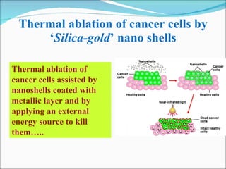 Thermal ablation of cancer cells by ‘ Silica-gold ’ nano shells Thermal ablation of cancer cells assisted by nanoshells coated with metallic layer and by applying an external energy source to kill them….. 