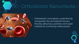 IV:- Orthodontic Nanorobots :
◇ Orthodontic nanorobots could directly
manipulate the periodontal tissues,
thereby allowing a painless and rapid
method for correcting malocclusion
11
 