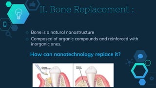 II. Bone Replacement :
How can nanotechnology replace it?
◇ Bone is a natural nanostructure
◇ Composed of organic compounds and reinforced with
inorganic ones.
 
