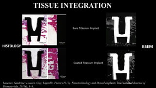 BSEM
TISSUE INTEGRATION
Lavenus, Sandrine; Louarn, Guy; Layrolle, Pierre (2010). Nanotechnology and Dental Implants. International Journal of
Biomaterials, 2010(), 1–9.
Bare Titanium Implant
Coated Titanium Implant
HISTOLOGY
 