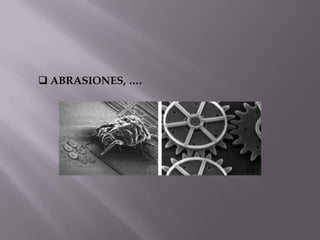  ABRASIONES, ….
 