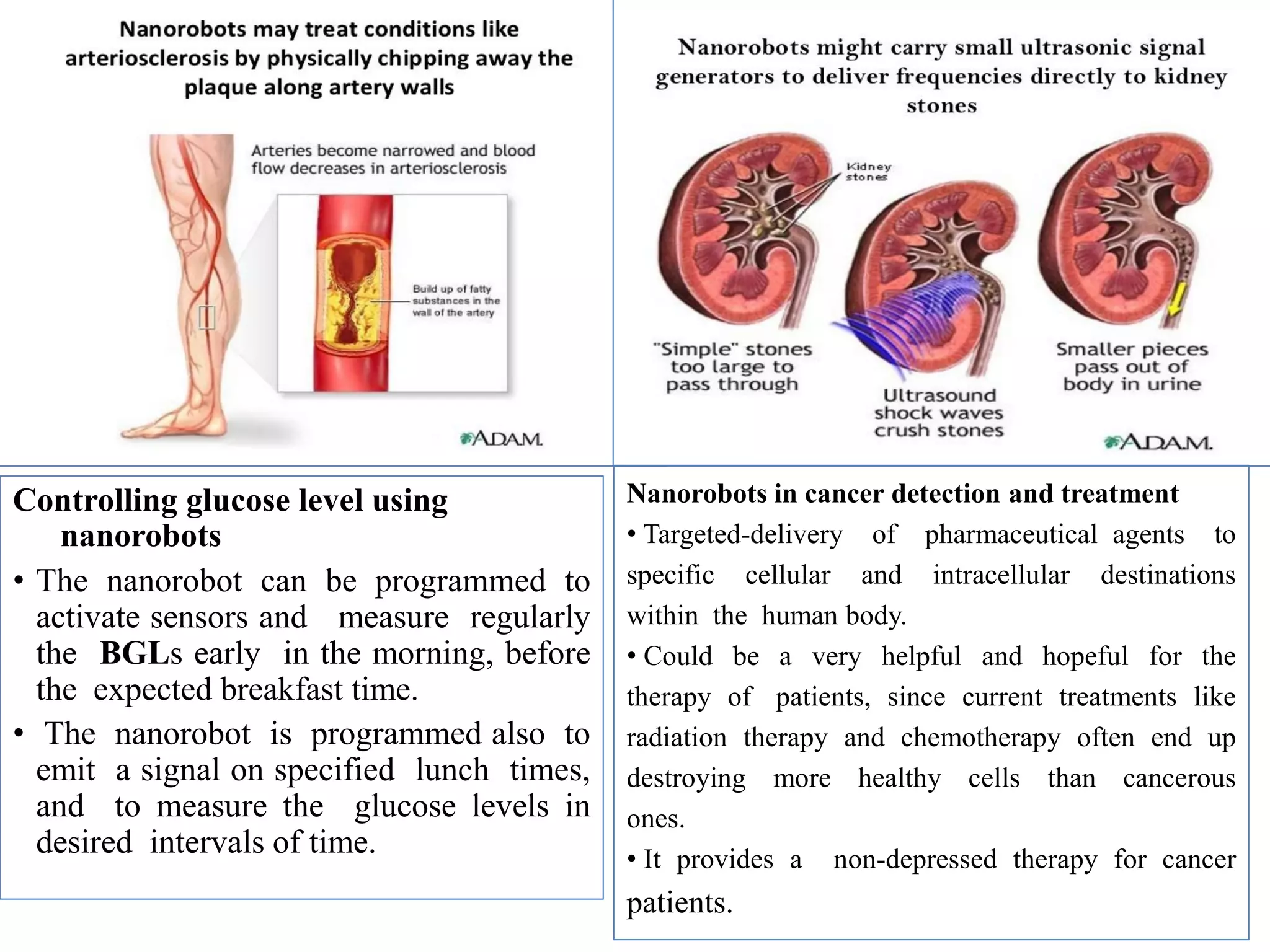Controlling glucose level using
nanorobots
• The nanorobot can be programmed to
activate sensors and measure regularly
the BGLs early in the morning, before
the expected breakfast time.
• The nanorobot is programmed also to
emit a signal on specified lunch times,
and to measure the glucose levels in
desired intervals of time.
Nanorobots in cancer detection and treatment
• Targeted-delivery of pharmaceutical agents to
specific cellular and intracellular destinations
within the human body.
• Could be a very helpful and hopeful for the
therapy of patients, since current treatments like
radiation therapy and chemotherapy often end up
destroying more healthy cells than cancerous
ones.
• It provides a non-depressed therapy for cancer
patients.
 