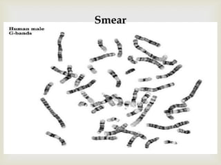 
Smear
 