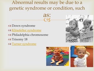 
 Down syndrome
 Klinefelter syndrome
 Philadelphia chromosome
 Trisomy 18
 Turner syndrome
Abnormal results may be due to a
genetic syndrome or condition, such
as:
 