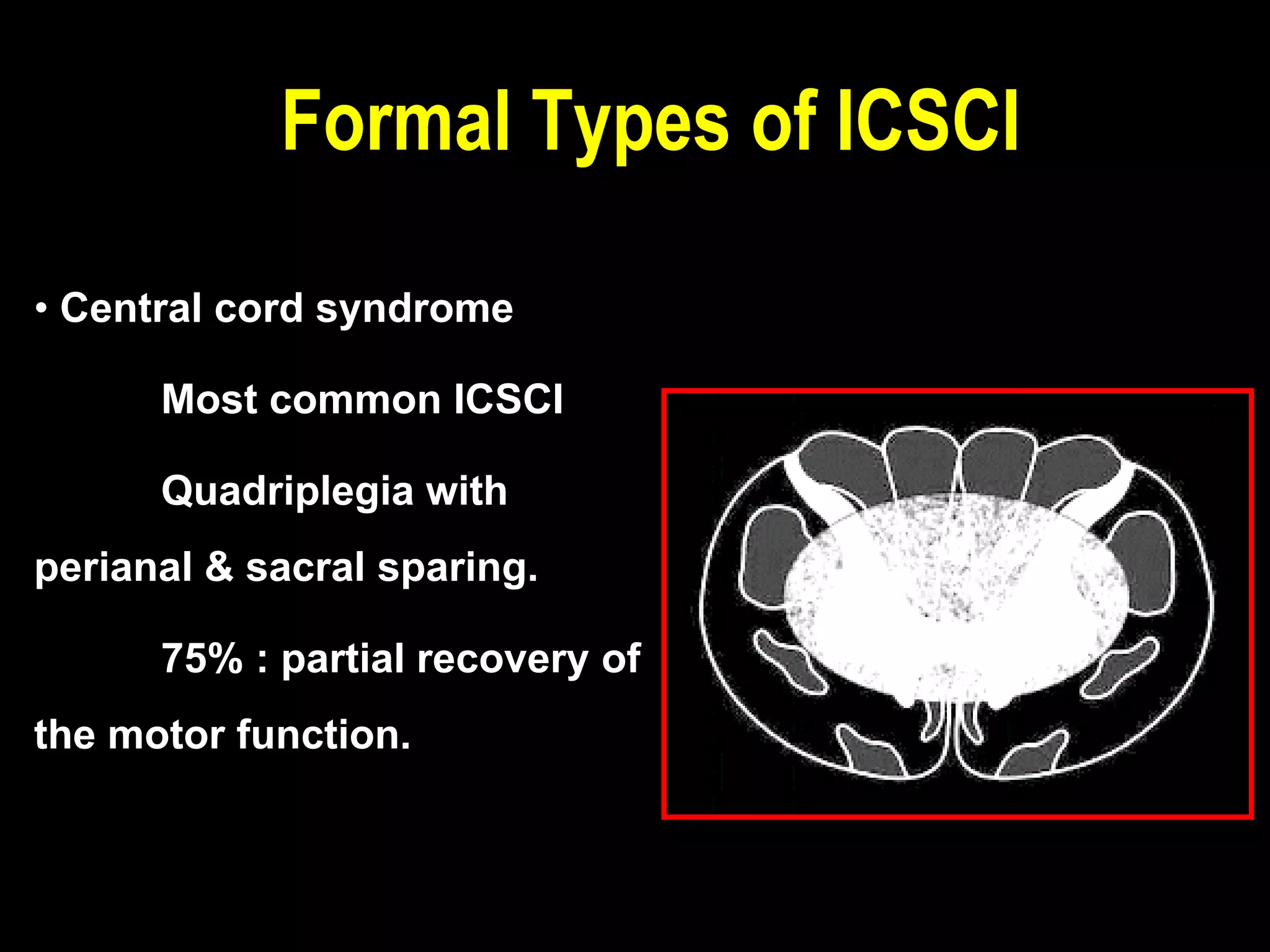 • Central cord syndrome
Most common ICSCI
Quadriplegia with
perianal & sacral sparing.
75% : partial recovery of
the motor function.
Formal Types of ICSCI
 