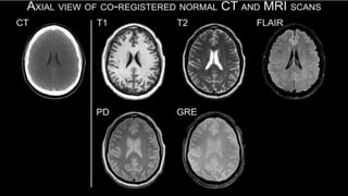 clinical application of CT/ MRI | PPTX