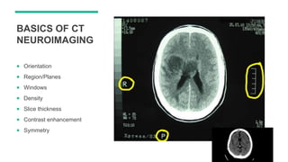 clinical application of CT/ MRI | PPTX
