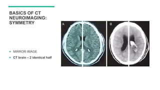 clinical application of CT/ MRI | PPTX