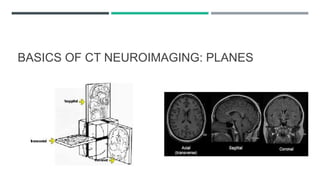 clinical application of CT/ MRI | PPTX