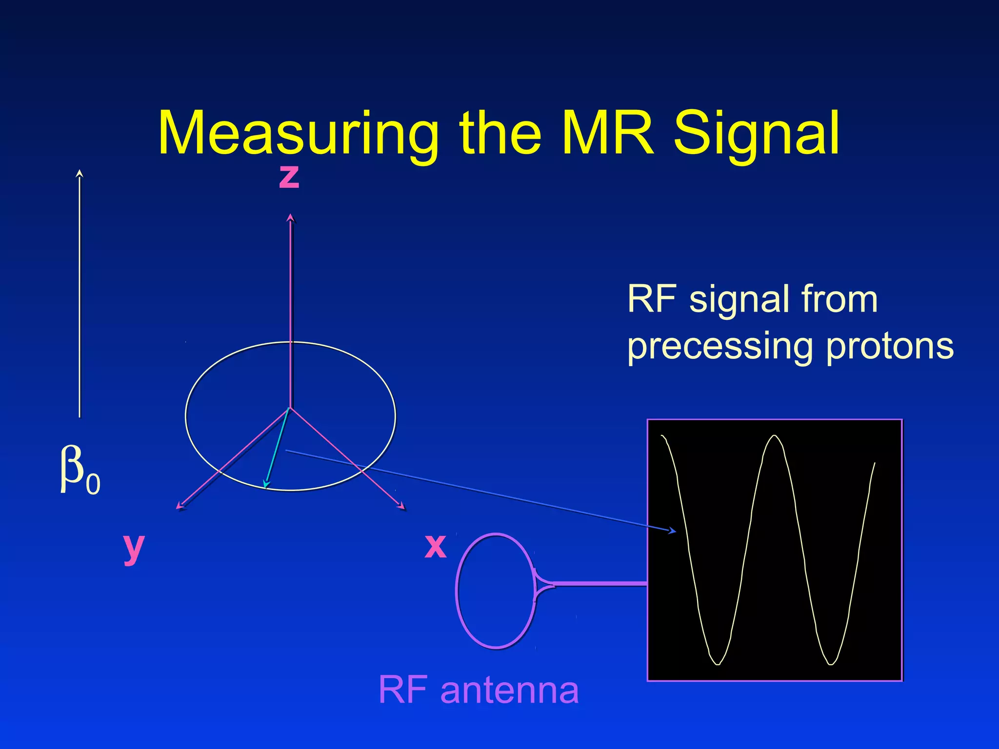 Measuring the MR Signal
z
y x
RF signal from
precessing protons
RF antenna
β0
 