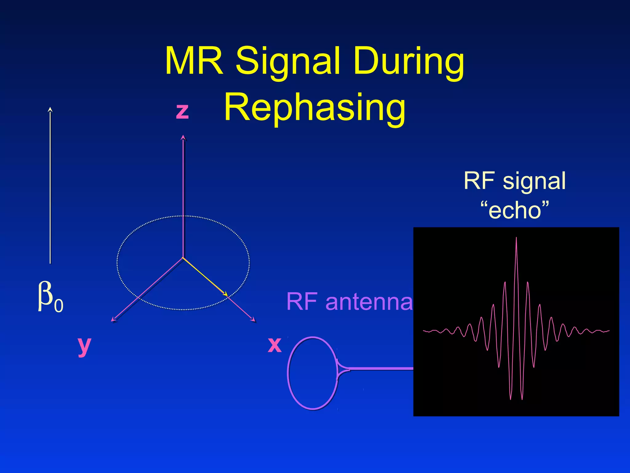 MR Signal During
Rephasingz
y x
RF signal
“echo”
RF antennaβ0
 