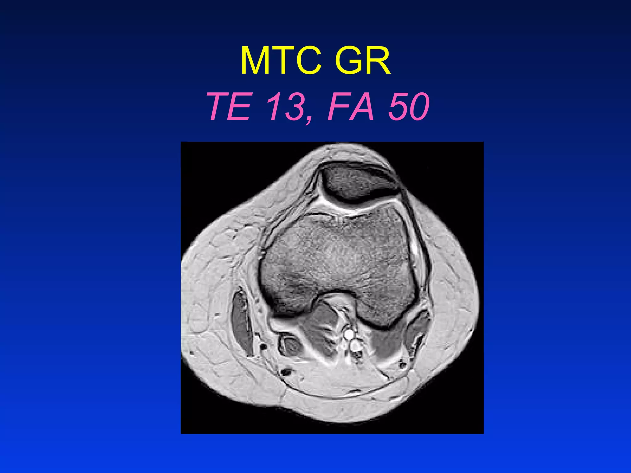 MTC GR
TE 13, FA 50
 