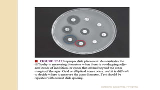 ANTIBIOTIC SUSCEPTIBILITY TESTING
 