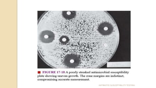 ANTIBIOTIC SUSCEPTIBILITY TESTING
 