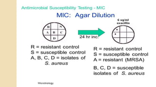 ANTIBIOTIC SUSCEPTIBILITY TESTING
 