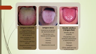 Lengua suburral 
Capa blanco-amarillenta 
adherida 
a la superficie dorsal 
de la lengua 
-Mas notable en las 
mañanas 
-Disminución del flujo 
salival 
-Respiran por la boca 
-Fumadores 
Lengua seca 
Valoramos el grado 
de deshidratación 
-Pacientes con 
fiebres prolongadas 
-Uremia 
-Vómito 
-Diarrea 
-Respiración bucal 
Glositis atrófica 
( lengua lisa) 
Atrofia de las 
papilas 
-Pacientes con 
anemia perniciosa 
o hipocrómica 
-Esprúe 
-Pelagra 
-Otras deficiencias 
nutricionales 
 