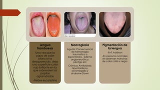 Lengua 
frambuesa 
Una vez que la 
capa de sabrr 
blanca ha 
desaparecido, deja 
una superficie color 
rojo brillante en la 
que sobresalen las 
papilas 
agramdadas 
-Fiebre escarlatina 
Macroglosia 
Aguda: Consecuencia 
de hemorragia 
traumatica o 
espontanea , edema 
angioneurótico, 
pénfigo etc 
Crónica: Amiloidosis; 
hiporitoidismo, 
acromegalia y 
sindrome Down 
Pigmentación de 
la lengua 
-Enf. Addison 
-En personas normales 
se observan manchas 
de color café o negro 
 