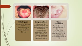 Sífilis lingual: 
Presenta en distintas 
formas: 
-Chancro lingual 
-Placas mucosas 
-Gomas 
Lengua vellosa: 
Hipertrofia de 
papilas filiformes, en 
especial delante de 
la V lingual 
-Por acción de 
pigmentos como 
café, tabaco , mx 
pueden presentar 
aspecto de vellos 
color café o negro 
Ulcera 
traumática: 
Puede deberse a 
bordes dentarios 
ásperos, 
mordeduras, 
alimentos irritantes, 
aplicación local de 
una pastilla de 
ácido acetilaslicílico 
etc. 
 