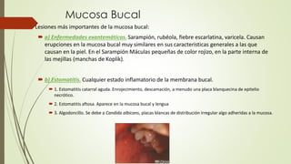 Mucosa Bucal 
 Lesiones más importantes de la mucosa bucal: 
 a) Enfermedades exantemáticas. Sarampión, rubéola, fiebre escarlatina, varicela. Causan 
erupciones en la mucosa bucal muy similares en sus caracteristicas generales a las que 
causan en la piel. En el Sarampión Máculas pequeñas de color rojizo, en la parte interna de 
las mejillas (manchas de Koplik). 
 b) Estomatitis. Cualquier estado inflamatorio de la membrana bucal. 
 1. Estomatitis catarral aguda. Enrojecimiento, descamación, a menudo una placa blanquecina de epitelio 
necrótico. 
 2. Estomatitis aftosa. Aparece en la mucosa bucal y lengua 
 3. Algodoncillo. Se debe a Candida albicans, placas blancas de distribución irregular algo adheridas a la mucosa. 
 