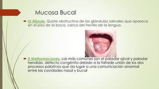 Mucosa Bucal 
 h) Ránula. Quiste obstructivo de las glándulas salivales que aparece 
en el piso de la boca, cerca del frenillo de la lengua. 
 i) Malformaciones. Las más comunes son el paladar ojival y paladar 
hendido, defecto congénito debido a la faltade unión de los dos 
procesos palatinos que da lugar a una comunicación anormal 
entre las cavidades nasal y bucal 
 
