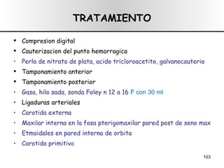 TRATAMIENTO Compresion digital Cauterizacion del punto hemorragico Perla de nitrato de plata, acido tricloroacetito, galvanocauterio Tamponamiento anterior Tamponamiento posterior Gasa, hilo sada, sonda Foley n 12 a 16  F  con 30 ml Ligaduras arteriales Carotida externa Maxilar interna en la fosa pterigomaxilar pared post de seno max Etmoidales en pared interna de orbita Carotida primitiv a 