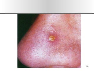 Nariz y senos paranasales