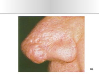 Nariz y senos paranasales